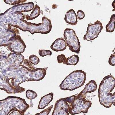 Immunohistochemistry-Paraffin: FAM227B Antibody [NBP2-14690] - Staining of human placenta shows strong cytoplasmic positivity in trophoblastic cells.