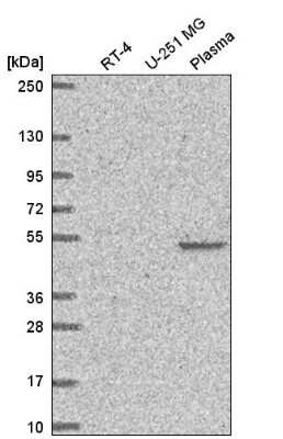 Western Blot: FAM227B Antibody [NBP2-56416] - Western blot analysis in human cell line RT-4, human cell line U-251 MG and human plasma.