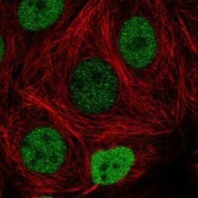 Immunocytochemistry/Immunofluorescence: FAM240C Antibody [NBP3-17160] - Staining of human cell line MCF7 shows localization to nucleoplasm.
