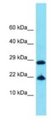 Western Blot: FAM25E Antibody [NBP3-09709] - Western blot analysis of FAM25E in Human COLO205 Whole Cell. Antibody dilution at 1ug/ml