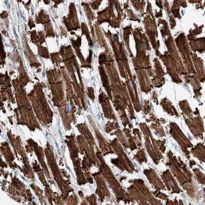 Immunohistochemistry-Paraffin FAM26E Antibody - BSA Free