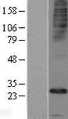 Western Blot FAM26E Overexpression Lysate