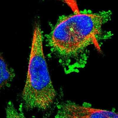 Immunocytochemistry/Immunofluorescence: FAM29A Antibody [NBP1-88022] - Immunofluorescent staining of human cell line U-251 MG shows localization to cytosol & microtubule organizing center.