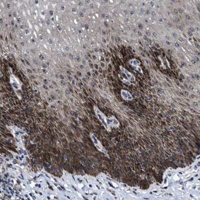 Immunohistochemistry-Paraffin: FAM29A Antibody [NBP1-88021] - Staining of human esophagus shows strong positivity in squamous epithelial cells.