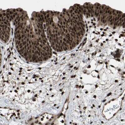 Immunohistochemistry-Paraffin: FAM29A Antibody [NBP1-88022] - Staining of human urinary bladder shows strong nuclear and cytoplasmic positivity.