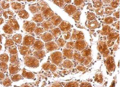 Immunohistochemistry-Paraffin: FAM29A Antibody [NBP2-16416] - HAUS6 protein at on colon carcinoma