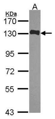 Western Blot: FAM29A Antibody [NBP2-16416] - Sample (30 ug of whole cell lysate) A: JurKat 7. 5% SDS PAGE gel, diluted at 1:1000.