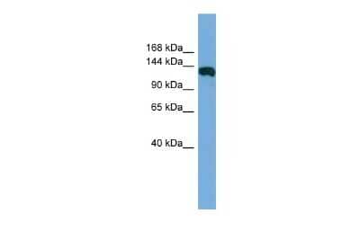 Western Blot: FAM29A Antibody [NBP2-87417] - WB Suggested Anti-FAM29A Antibody Titration: 0.2-1 ug/ml. ELISA Titer: 1:312500. Positive Control: Human Muscle