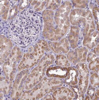 Immunohistochemistry-Paraffin FAM36A Antibody