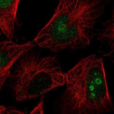 Immunocytochemistry/Immunofluorescence: FAM3A Antibody [NBP2-55027] - Staining of human cell line U-251 MG shows localization to nucleus & nucleoli.