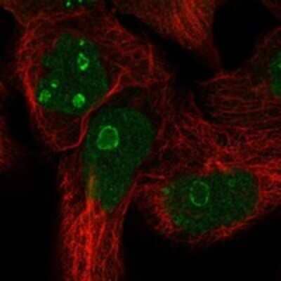 Immunocytochemistry/Immunofluorescence: FAM3A Antibody [NBP3-17844] - Staining of human cell line EFO-21 shows localization to nucleoplasm & nucleoli rim.