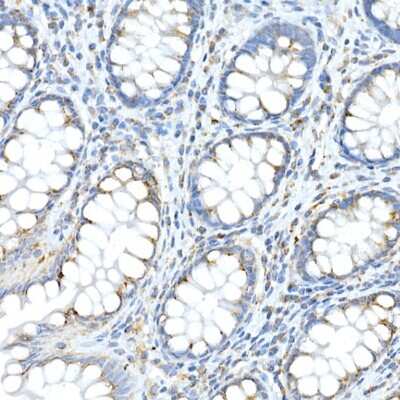 Immunohistochemistry-Paraffin: FAM3A Antibody [NBP3-16063] - Immunohistochemistry of paraffin-embedded human colon using FAM3A Rabbit pAb (NBP3-16063) at dilution of 1:50 (40x lens).Perform high pressure antigen retrieval with 10 mM citrate buffer pH 6.0 before commencing with IHC staining protocol.