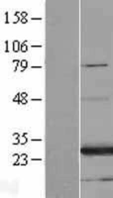 Western Blot: FAM3A Overexpression Lysate (Adult Normal) [NBL1-10521] Left-Empty vector transfected control cell lysate (HEK293 cell lysate); Right -Over-expression Lysate for FAM3A.