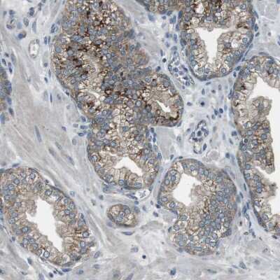 Immunohistochemistry-Paraffin: FAM3B Antibody [NBP1-89395] - Staining of human prostate shows weak to moderate positivity in cytoplasm granular in glandular cells.