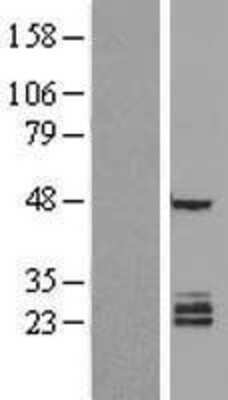 Western Blot: FAM3B Overexpression Lysate (Adult Normal) [NBL1-10522] Left-Empty vector transfected control cell lysate (HEK293 cell lysate); Right -Over-expression Lysate for FAM3B.