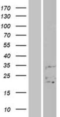 Western Blot: FAM3B Overexpression Lysate (Adult Normal) [NBP2-04455] Left-Empty vector transfected control cell lysate (HEK293 cell lysate); Right -Over-expression Lysate for FAM3B.