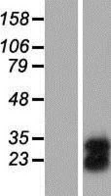 Western Blot: FAM3C Overexpression Lysate (Adult Normal) [NBP2-08540] Left-Empty vector transfected control cell lysate (HEK293 cell lysate); Right -Over-expression Lysate for FAM3C.