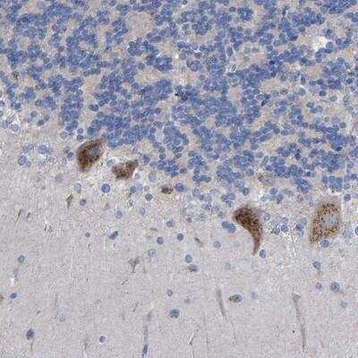 Immunohistochemistry-Paraffin FAM40B Antibody