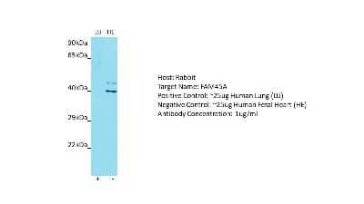 Western Blot: FAM45A Antibody [NBP2-82682] - Host: Rabbit. Target: FAM45A. Positive control (+): Human Lung (LU). Negative control (-): Human Fetal Heart (HE). Antibody concentration: 1ug/ml