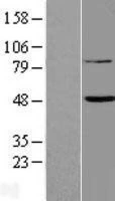 Western Blot FAM46B Overexpression Lysate