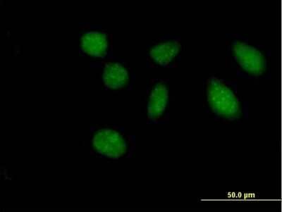 Immunocytochemistry/ Immunofluorescence FAM47B Antibody - Azide and BSA Free