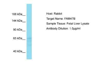 Western Blot: FAM47B Antibody [NBP2-87420] - Host: Rabbit. Target Name: FAM47B. Sample Type: Fetal Liver lysates. Antibody Dilution: 1.0ug/ml