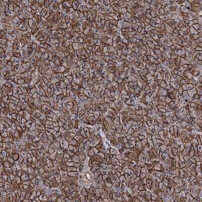 Immunohistochemistry-Paraffin: FAM48A Antibody [NBP1-90794] - Staining of human pancreas shows strong nucleolar positivity combined with distinct membranous and cytoplasmic staining in exocrine cells.