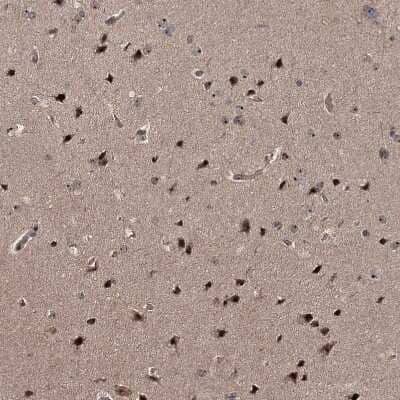 Immunohistochemistry-Paraffin: FAM48A Antibody [NBP1-90794] - Staining of human Cerebral cortex shows strong positivity in nucleoli in neuronal and glial cells.