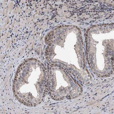 Immunohistochemistry-Paraffin: FAM48A Antibody [NBP1-90794] - Staining of human Prostate shows moderate positivity in nucleoli in glandular cells.