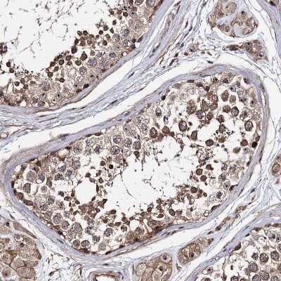 Immunohistochemistry-Paraffin: FAM48A Antibody [NBP1-90794] - Staining of human Testis shows strong positivity in nucleoli in cells in seminiferous ducts.