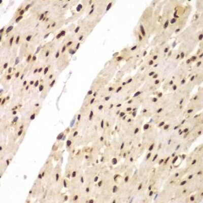 Immunohistochemistry-Paraffin: FAM48A Antibody [NBP3-03767] - Paraffin-embedded human colon using FAM48A antibody at dilution of 1:100 (40x lens).