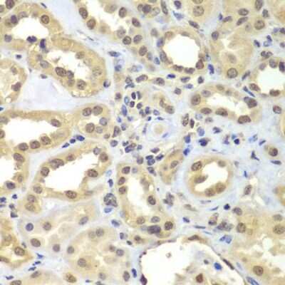 Immunohistochemistry-Paraffin: FAM48A Antibody [NBP3-03767] - Paraffin-embedded human kidney using FAM48A antibody at dilution of 1:100 (40x lens).