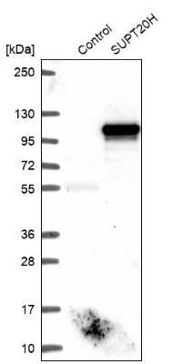 Western Blot: FAM48A Antibody [NBP1-90794] - Analysis in control (vector only transfected HEK293T lysate) and SUPT20H over-expression lysate (Co-expressed with a C-terminal myc-DDK tag (3.1 kDa) in mammalian HEK293T cells).