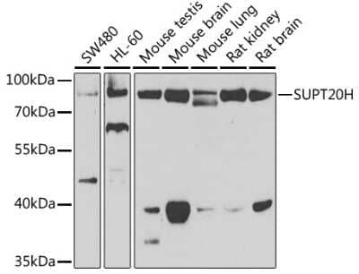 Western Blot: FAM48A Antibody [NBP3-03767] - Analysis of extracts of various cell lines, using FAM48A antibody at 1:1000 dilution. Secondary antibody: HRP Goat Anti-Rabbit IgG (H+L) at 1:10000 dilution. Lysates/proteins: 25ug per lane. Blocking buffer: 3% nonfat dry milk in TBST. Detection: ECL Enhanced Kit