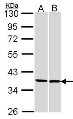 Western Blot: FAM50A Antibody [NBP1-33494] - Sample (30 ug of whole cell lysate) A: 293T B: H1299 10% SDS PAGE; antibody diluted at 1:1000.