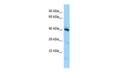 Western Blot: FAM50A Antibody [NBP3-10708] - Western blot analysis of FAM50A in 293T Whole Cell lysates. Antibody dilution at 1.0ug/ml