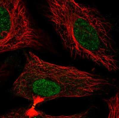 Immunocytochemistry/ Immunofluorescence FAM50B Antibody