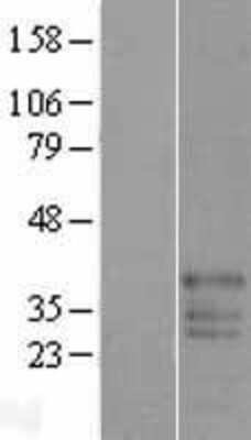 Western Blot FAM50B Overexpression Lysate