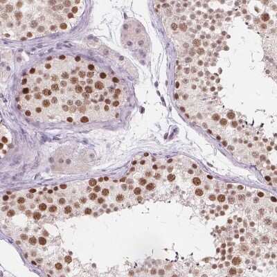 Immunohistochemistry: FAM53A Antibody [NBP2-49274] - Staining of human testis shows strong nuclear positivity in cells of seminiferus ducts.