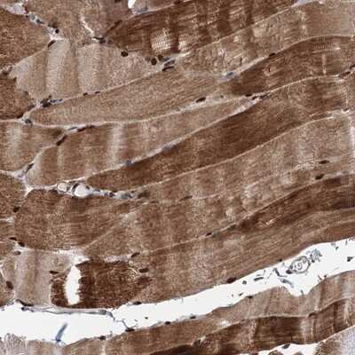 Immunohistochemistry-Paraffin: FAM53A Antibody [NBP1-84998] - Staining of human skeletal muscle shows distinct nuclear and cytoplasmic positivity in myocytes.