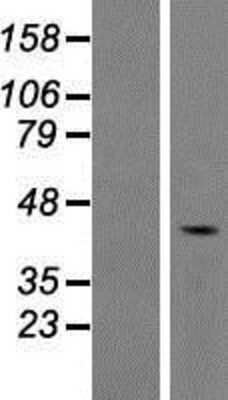 Western Blot: FAM53A Overexpression Lysate (Adult Normal) [NBP2-08722] Left-Empty vector transfected control cell lysate (HEK293 cell lysate); Right -Over-expression Lysate for FAM53A.