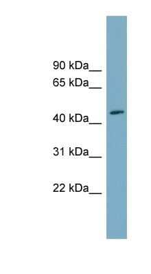 Western Blot: FAM53C Antibody [NBP1-55381] - Human Small Intestine, concentration 0.2-1 ug/ml.