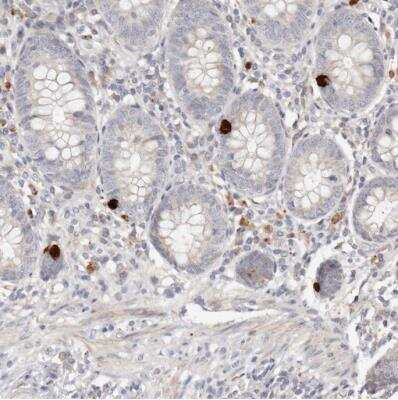 Immunohistochemistry-Paraffin FAM54A Antibody