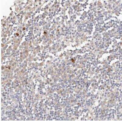 Immunohistochemistry-Paraffin FAM54A Antibody - BSA Free
