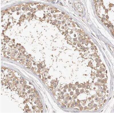Immunohistochemistry-Paraffin FAM54A Antibody - BSA Free