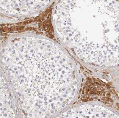 Immunohistochemistry-Paraffin FAM54A Antibody - BSA Free