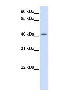 Western Blot: FAM54A Antibody [NBP1-56563] - Human Muscle lysate, concentration 0.2-1 ug/ml.
