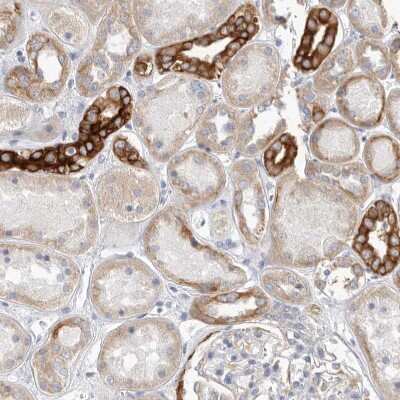 Immunohistochemistry-Paraffin: FAM54B Antibody [NBP1-86400] - Staining of human kidney shows moderate to strong cytoplasmic positivity in cells in tubules.
