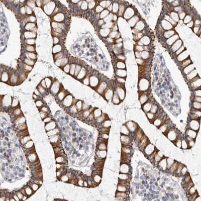 Immunohistochemistry-Paraffin: FAM54B Antibody [NBP1-86400] - Staining of human gastrointestinal shows moderate to strong cytoplasmic and membranous positivity in glandular cells.