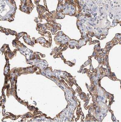Immunohistochemistry-Paraffin: FAM54B Antibody [NBP1-86400] - Staining of human lung shows moderate to strong cytoplasmic and membranous positivity in pneumocytes.